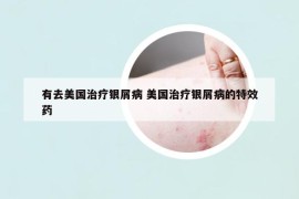 有去美國(guó)治療銀屑病 美國(guó)治療銀屑病的特效藥