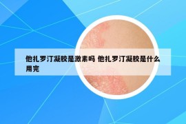 他扎羅汀凝膠是激素嗎 他扎羅汀凝膠是什么用完