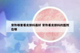 常熟哪里看皮膚科最好 常熟看皮膚科的醫(yī)院在哪