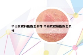 華山皮膚科醫(yī)院怎么樣 華山皮膚病醫(yī)院怎么樣