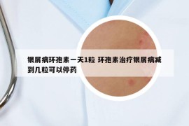 銀屑病環(huán)孢素一天1粒 環(huán)孢素治療銀屑病減到幾?？梢酝Ｋ? /></a>		
		</figure>

		<header class=