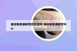 維坊銀屑病研究院靠譜嗎 濰坊銀屑病研究中心
