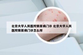 北京大學(xué)人民醫(yī)院銀屑病門診 北京大學(xué)人民醫(yī)院銀屑病門診怎么樣