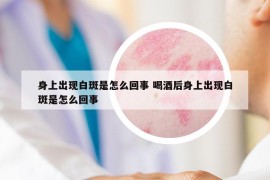身上出現(xiàn)白斑是怎么回事 喝酒后身上出現(xiàn)白斑是怎么回事