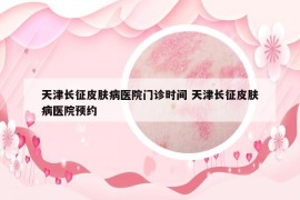 天津長征皮膚病醫(yī)院門診時間 天津長征皮膚病醫(yī)院預(yù)約