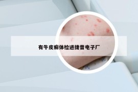 有牛皮癬體檢進捷普電子廠