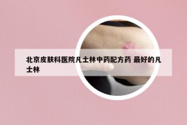 北京皮膚科醫(yī)院凡士林中藥配方藥 最好的凡士林
