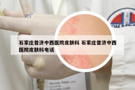 石家莊普濟中西醫(yī)院皮膚科 石家莊普濟中西醫(yī)院皮膚科電話
