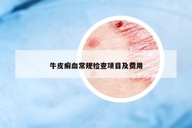 牛皮癬血常規(guī)檢查項(xiàng)目及費(fèi)用