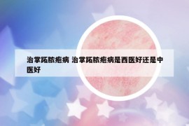 治掌跖膿皰病 治掌跖膿皰病是西醫(yī)好還是中醫(yī)好