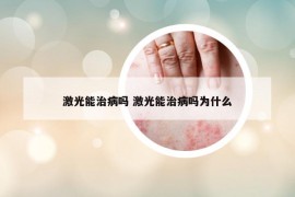 激光能治病嗎 激光能治病嗎為什么