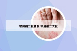 銀屑病三征名解 銀屑病三大征
