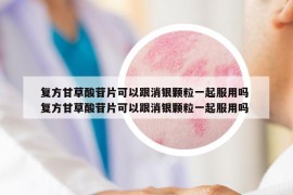復(fù)方甘草酸苷片可以跟消銀顆粒一起服用嗎 復(fù)方甘草酸苷片可以跟消銀顆粒一起服用嗎