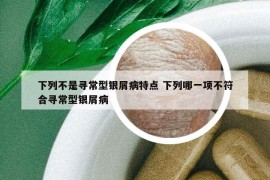 下列不是尋常型銀屑病特點(diǎn) 下列哪一項(xiàng)不符合尋常型銀屑病