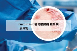 ruxolitinib乳膏銀屑病 銀屑病 潤體乳
