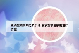 點(diǎn)滴型銀屑病怎么護(hù)理 點(diǎn)滴型銀屑病的治療方案