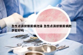 急性點(diǎn)滴狀銀屑病泡澡 急性點(diǎn)滴狀銀屑病跑步能好嗎