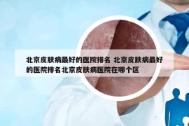 北京皮膚病最好的醫(yī)院排名 北京皮膚病最好的醫(yī)院排名北京皮膚病醫(yī)院在哪個(gè)區(qū)