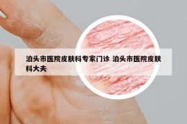 泊頭市醫(yī)院皮膚科專家門診 泊頭市醫(yī)院皮膚科大夫