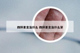 四環(huán)素主治什么 四環(huán)素主治什么牙