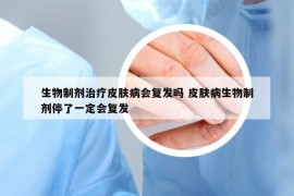 生物制劑治療皮膚病會復發(fā)嗎 皮膚病生物制劑停了一定會復發(fā)