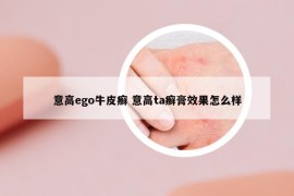 意高ego牛皮癬 意高ta癬膏效果怎么樣