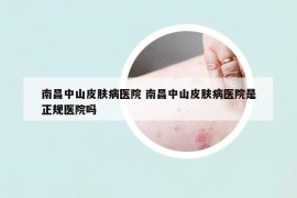 南昌中山皮膚病醫(yī)院 南昌中山皮膚病醫(yī)院是正規(guī)醫(yī)院嗎