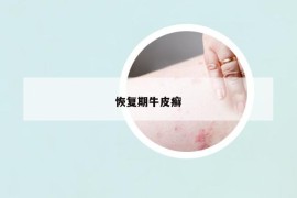 恢復(fù)期牛皮癬