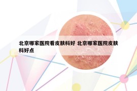 北京哪家醫(yī)院看皮膚科好 北京哪家醫(yī)院皮膚科好點