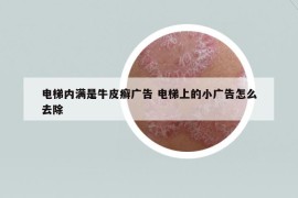 電梯內滿是牛皮癬廣告 電梯上的小廣告怎么去除