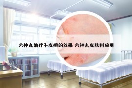六神丸治療牛皮癬的效果 六神丸皮膚科應(yīng)用