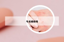 牛皮癬排毒
