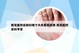 西苑醫(yī)院皮膚科哪個(gè)大夫看銀屑病 西苑醫(yī)院皮科專家