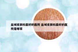 鹽城皮膚科最好的醫(yī)院 鹽城皮膚科最好的醫(yī)院是哪家