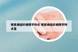 銀屑病組織病理學(xué)特點 銀屑病組織病理學(xué)特點是