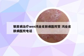 銀屑病治療wen鴻業(yè)皮膚病醫(yī)院贊 鴻業(yè)皮膚病醫(yī)院電話
