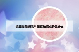 銀屑膠囊新疆產(chǎn) 銀屑膠囊成份是什么