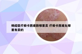 楊紹臣療癬卡西甫散哪里賣 療癬卡西甫丸哪里有賣的