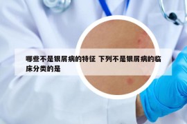 哪些不是銀屑病的特征 下列不是銀屑病的臨床分類的是