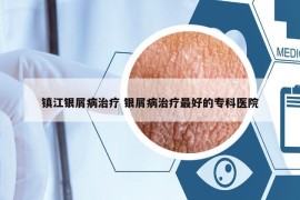 鎮(zhèn)江銀屑病治療 銀屑病治療最好的?？漆t(yī)院