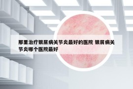 那里治療銀屑病關(guān)節(jié)炎最好的醫(yī)院 銀屑病關(guān)節(jié)炎哪個(gè)醫(yī)院最好