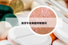 南京牛皮癬醫(yī)院哪里好
