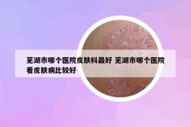 蕪湖市哪個醫(yī)院皮膚科最好 蕪湖市哪個醫(yī)院看皮膚病比較好