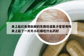 身上起紅色類(lèi)似癬的東西吃諾氟沙星管用嗎 身上起了一片片小紅癬吃什么藥好