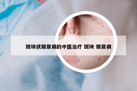 斑塊狀銀屑病的中醫(yī)治療 斑塊 銀屑病