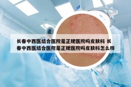 長春中西醫(yī)結(jié)合醫(yī)院是正規(guī)醫(yī)院嗎皮膚科 長春中西醫(yī)結(jié)合醫(yī)院是正規(guī)醫(yī)院嗎皮膚科怎么樣