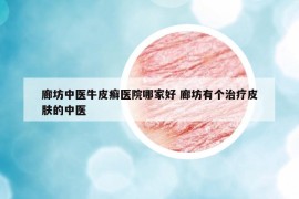 廊坊中醫(yī)牛皮癬醫(yī)院哪家好 廊坊有個(gè)治療皮膚的中醫(yī)