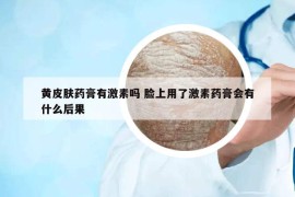 黃皮膚藥膏有激素嗎 臉上用了激素藥膏會有什么后果