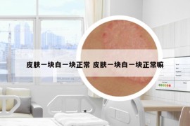 皮膚一塊白一塊正常 皮膚一塊白一塊正常嘛