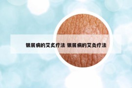 銀屑病的艾炙療法 銀屑病的艾灸療法